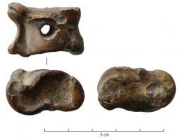 AML-3033 - Astragale percéeosAstragale perforée, sans autre aménagement de l'os naturel.