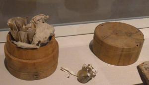 PYX-7001 - Pyxide
bois
Boîte cylindrique tournée : base et couvercle re rejoignent à mi-hauteur, le corps étant surmonté d'un redan où vient s'emboîter le couvercle; décor de filets tournés en haut du couvercle et en bas de la panse.